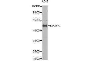 Western blot analysis of extracts of A549 cells, using SPDYA antibody. (SPDYA antibody)