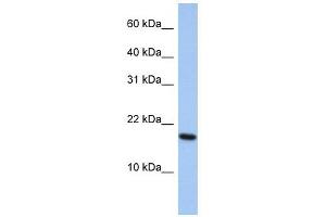 ARL5A antibody used at 1 ug/ml to detect target protein. (ARL5A antibody  (Middle Region))