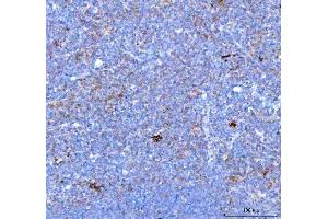 IHC analysis of PDCD1 using anti PDCD1 antibody (ABIN5518784). (PD-1 antibody  (N-Term))