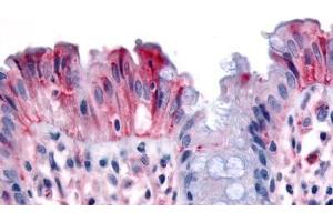Human Colon, Surface Epithelium (formalin-fixed, paraffin-embedded) stained with MST1R antibody ABIN213539 at 3 ug/ml followed by biotinylated goat anti-rabbit IgG secondary antibody ABIN481713, alkaline phosphatase-streptavidin and chromogen. (MST1R antibody  (Internal Region))