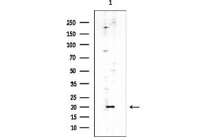 anti-Interleukin 1 Family, Member 10 (Theta) (IL1F10) (Internal Region) antibody