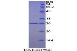 SDS-PAGE (SDS) image for Heparanase (HPSE) (AA 54-278) protein (His tag) (ABIN1879436)