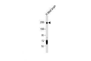Western Blot at 1:8000 dilution + human fetal brain lysate Lysates/proteins at 20 ug per lane. (L1CAM antibody  (C-Term))