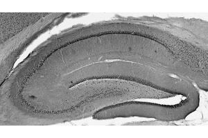 Adult rat hippocampus immunohistochemistry.