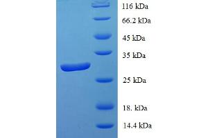 SDS-PAGE (SDS) image for Inhibitor of DNA Binding 1, Dominant Negative Helix-Loop-Helix Protein (ID1) (AA 1-155), (full length) protein (His-SUMO Tag) (ABIN5709693)