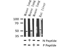 Western blot analysis of Phospho-VASP (Ser157) expression in various lysates (VASP antibody  (pSer157))