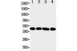 Anti-IL3RA antibody, Western blotting Lane 1: A431 Cell Lysate Lane 2: SMMC Cell Lysate Lane 3: U87 Cell Lysate Lane 4: 293T Cell Lysate (IL3RA antibody  (Middle Region))