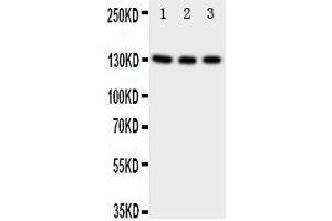 Anti-TrkC antibody, Western blotting Lane 1: Rat Brain Tissue Lysate Lane 2: Mouse Brain Tissue Lysate Lane 3: U87 Cell Lysate (NTRK3 antibody  (N-Term))