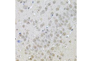 Immunohistochemistry of paraffin-embedded mouse brain using DR1 Antibody (ABIN5975441) at dilution of 1/100 (40x lens). (DR1 antibody)