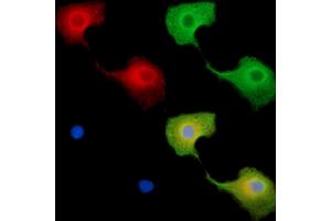 ABIN7096228 and ABIN7100290 staining  cells by IF/ICC. (BTBD8 antibody)