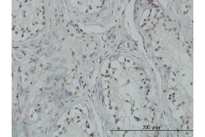 Immunostaining (ISt) image for anti-Tumor Protein P53 Binding Protein 2 (TP53BP2) (AA 511-610) antibody (ABIN563231)
