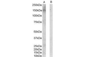 Western Blotting (WB) image for anti-Centrosomal Protein 70kDa (CEP70) (N-Term) antibody (ABIN2787764)