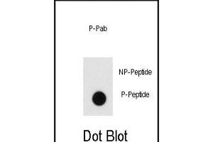 Dot blot analysis of anti-Phospho-Endophilin-pY80 Pab (ABIN650823 and ABIN2839797) on nitrocellulose membrane. (Endophilin (pTyr80) antibody)