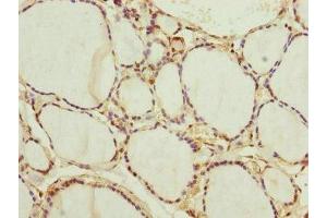 Immunohistochemistry (IHC) image for anti-Neural Precursor Cell Expressed, Developmentally Down-Regulated 1 (NEDD1) (AA 411-660) antibody (ABIN7165859)