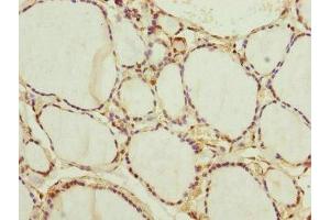 Immunohistochemistry of paraffin-embedded human thyroid tissue using ABIN7165859 at dilution of 1:100
