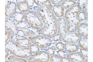 Immunohistochemistry of paraffin-embedded rat kidney using SNAI1 antibody. (SNAIL antibody)