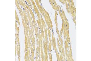 Immunohistochemistry of paraffin-embedded mouse heart using CSRP3 Antibody (ABIN5973946) at dilution of 1/100 (40x lens). (CSRP3 antibody)