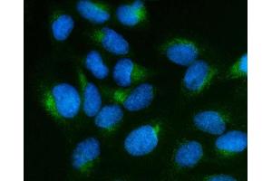IF analysis of SCG10/STMN2 using anti-SCG10/STMN2 antibody (ABIN7600734). (STMN2 antibody  (AA 23-170))