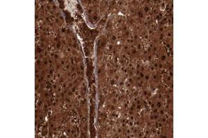 Immunohistochemical staining of human liver with FTSJ1 polyclonal antibody  shows strong nuclear and cytoplasmic positivity in hepatocytes and extracellular positivity in blood vessels . (FTSJ1 antibody)