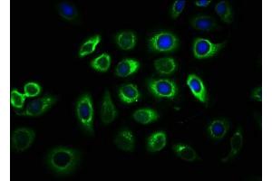 Immunofluorescence staining of A549 cells with ABIN7147047 at 1:33, counter-stained with DAPI. (IGF2R antibody  (AA 2328-2491))