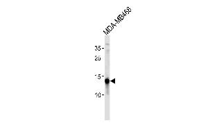 TPD52L3 Antibody (N-term) (ABIN1881899 and ABIN2843497) western blot analysis in MDA-M cell line lysates (35 μg/lane). (TPD52L3 antibody  (N-Term))