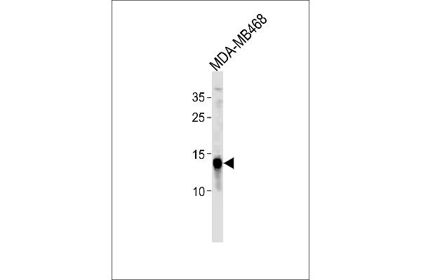 TPD52L3 antibody  (N-Term)
