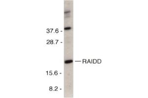 Image no. 2 for anti-CASP2 and RIPK1 Domain Containing Adaptor with Death Domain (CRADD) (C-Term) antibody (ABIN201312) (CRADD antibody  (C-Term))
