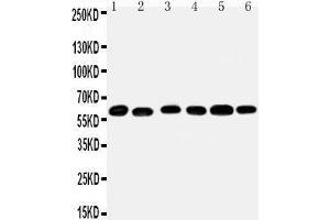 Anti-Monoamine Oxidase B antibody, Western blotting Lane 1: Mouse Liver Tissue Lysate Lane 2: Mouse Lung Tissue Lysate Lane 3: Rat Kidney Tissue Lysate Lane 4: Rat Brain Tissue Lysate Lane 5: Rat Liver Tissue Lysate Lane 6: Rat Lung Tissue Lysate (Monoamine Oxidase B antibody  (N-Term))