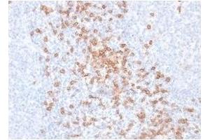 ABIN6383871 to CD8a was successfully used to stain T cells of in human tonsil sections. (Recombinant CD8 alpha antibody)