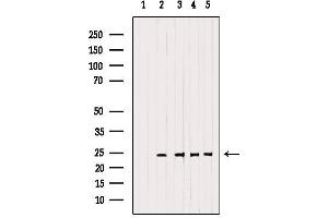 Western blot analysis of extracts from various samples, using RAB14 Antibody. (RAB14 antibody  (C-Term))