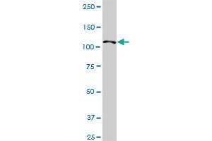 HIP1R MaxPab rabbit polyclonal antibody.