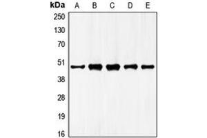 Western blot analysis of GATA4 expression in HepG2 (A), NIH3T3 (B), mouse liver (C), rat liver (D), rat kidney (E) whole cell lysates. (GATA4 antibody  (Center))