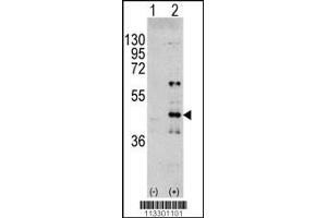Western blot analysis of MAPK3 using rabbit polyclonal MAPK3 Antibody (Y204) using 293 cell lysates (2 ug/lane) either nontransfected (Lane 1) or transiently transfected with the MAPK3 gene (Lane 2). (ERK1 antibody  (AA 182-211))