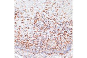 Immunohistochemistry of paraffin-embedded human esophageal using MRPL46 antibody (ABIN7268574) at dilution of 1:100 (40x lens). (MRPL46 antibody  (AA 1-279))