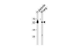 CREB3L2 Antibody (C-term) (ABIN653607 and ABIN2842970) western blot analysis in human placenta and mouse lung tissue lysates (35 μg/lane).