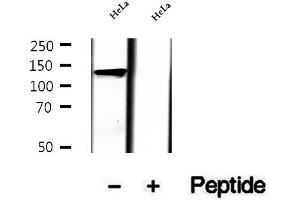 Western blot analysis of extracts of HeLa cells, using LRPPRC antibody. (LRPPRC antibody  (Internal Region))