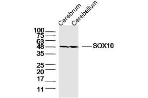 Lane 1: Mouse Cerebrum lysates Lane 2: Mouse Cerebellum lysates probed with SOX10 Polyclonal Antibody, Unconjugated  at 1:300 dilution and 4˚C overnight incubation. (SOX10 antibody  (AA 201-300))