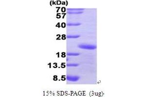 SDS-PAGE (SDS) image for Growth Arrest and DNA-Damage-Inducible, alpha (GADD45A) (AA 1-165) protein (His tag) (ABIN666990) (GADD45A Protein (AA 1-165) (His tag))