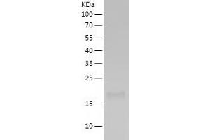 Western Blotting (WB) image for TNF Receptor Superfamily, Member 6 (FAS) (AA 17-173) protein (His tag) (ABIN7125404) (FAS Protein (AA 17-173) (His tag))