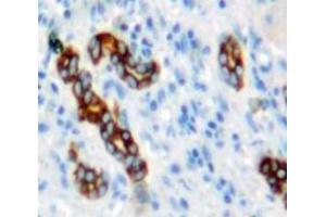 Used in DAB staining on fromalin fixed paraffin-embedded Liver tissue (NUMB antibody  (AA 377-642))