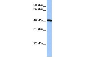WB Suggested Anti-FTSJ1 Antibody Titration:  0.