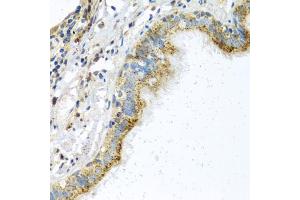Immunohistochemistry of paraffin-embedded human trachea using ATPIF1 antibody (ABIN5972942) at dilution of 1/100 (40x lens). (ATPase Inhibitory Factor 1 antibody)