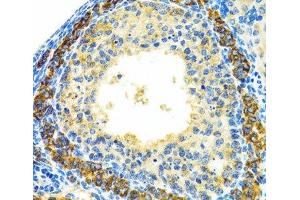 Immunohistochemistry of paraffin-embedded Rat ovary using MRPL28 Polyclonal Antibody at dilution of 1:100 (40x lens). (MRPL28 antibody)