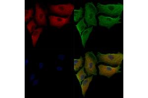 ACTN1/2/3/4 Antibody staining A549 cells by IF/ICC. (ACTN1/2/3/4 antibody)