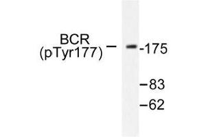 Image no. 1 for anti-Breakpoint Cluster Region (BCR) (pTyr177) antibody (ABIN317974) (BCR antibody  (pTyr177))