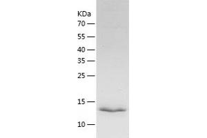 Mitogen-Activated Protein Kinase Kinase 1 Interacting Protein 1 (MAPKSP1) (AA 1-124) protein (His-IF2DI Tag)