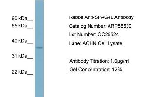 WB Suggested Anti-SPAG4L  Antibody Titration: 0. (SUN5 antibody  (N-Term))
