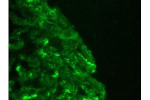 Image no. 2 for anti-Cardiotin antibody (ABIN335361) (Cardiotin antibody)