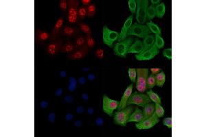 Phospho-Histone H3 (Thr3) Antibody staining Hela cells(heat shock treatment) by IF/ICC. (Histone 3 antibody  (H3T3ph))