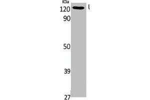 Western Blot analysis of Jurkat cells using UBE4A Polyclonal Antibody (UBE4A antibody  (N-Term))